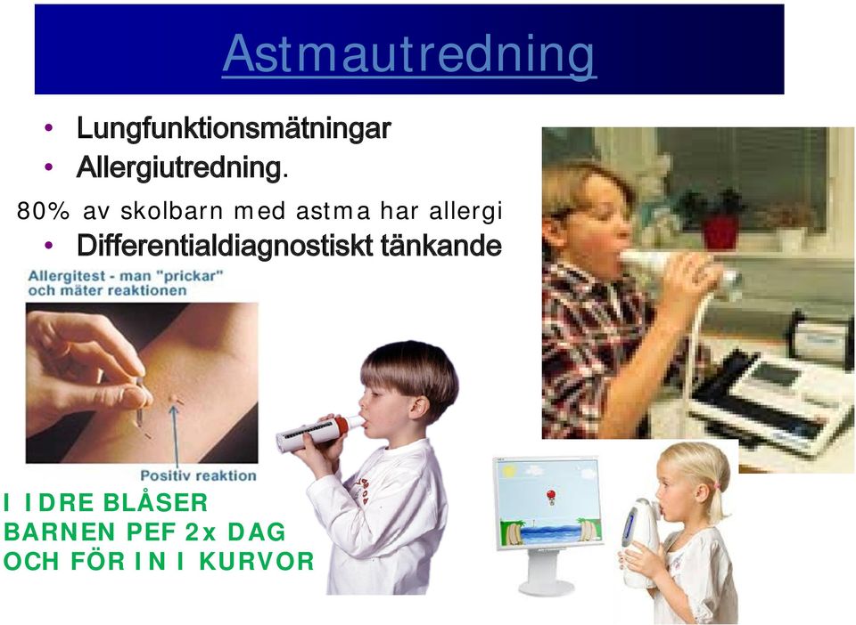 allergi Differentialdiagnostiskt tänkande I