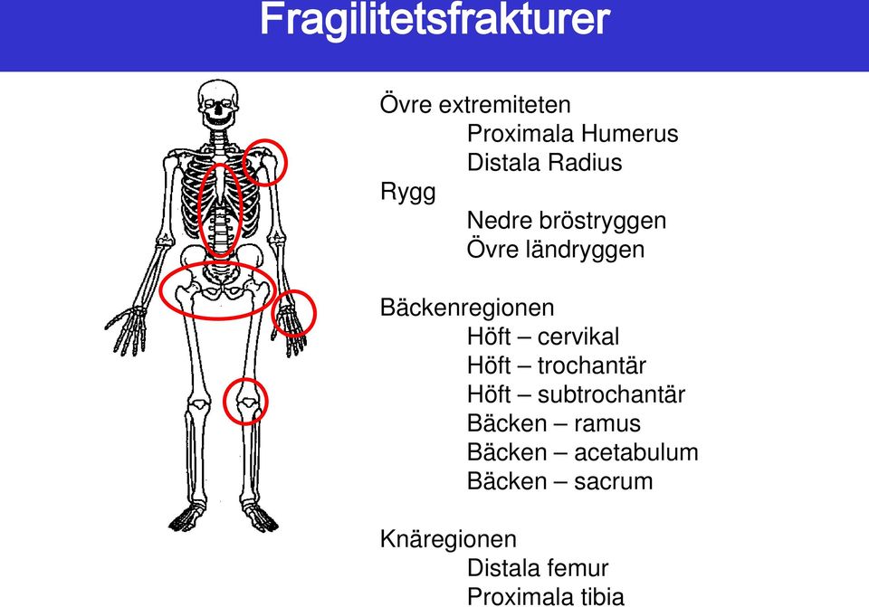 cervikal Höft trochantär Höft subtrochantär Bäcken ramus Bäcken