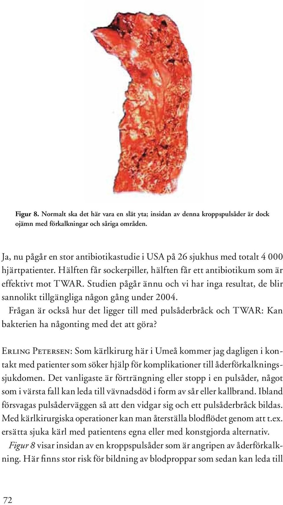 Studien pågår ännu och vi har inga resultat, de blir sannolikt tillgängliga någon gång under 2004.