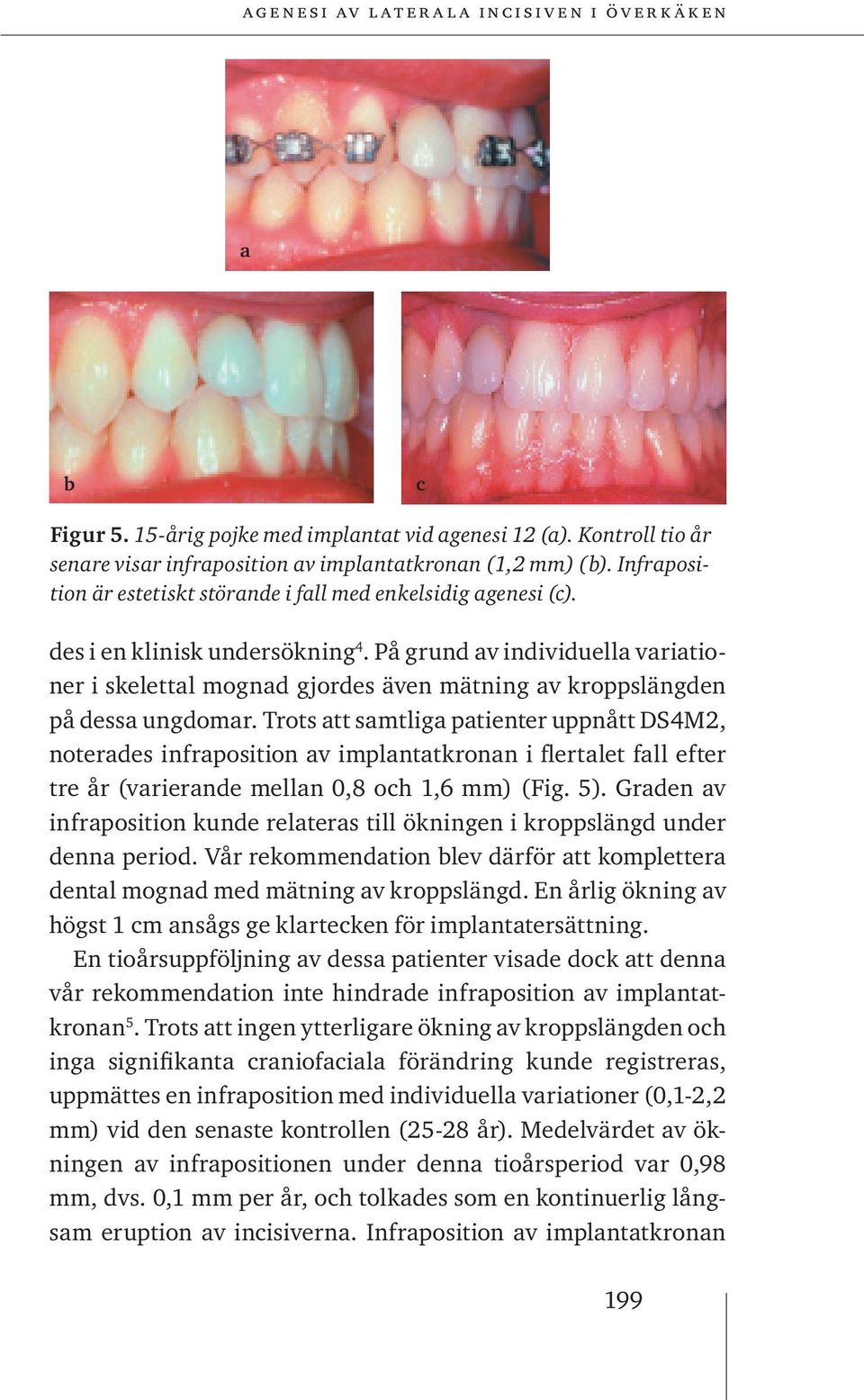 På grund av individuella variationer i skelettal mognad gjordes även mätning av kroppslängden på dessa ungdomar.