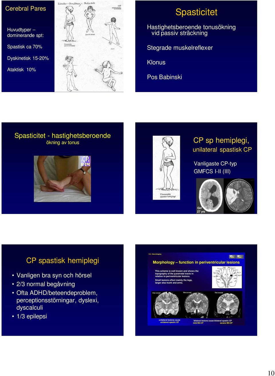 ADHD/beteendeproblem, perceptionsstörningar, dyslexi, dyscalculi 1/3 epilepsi Vl.