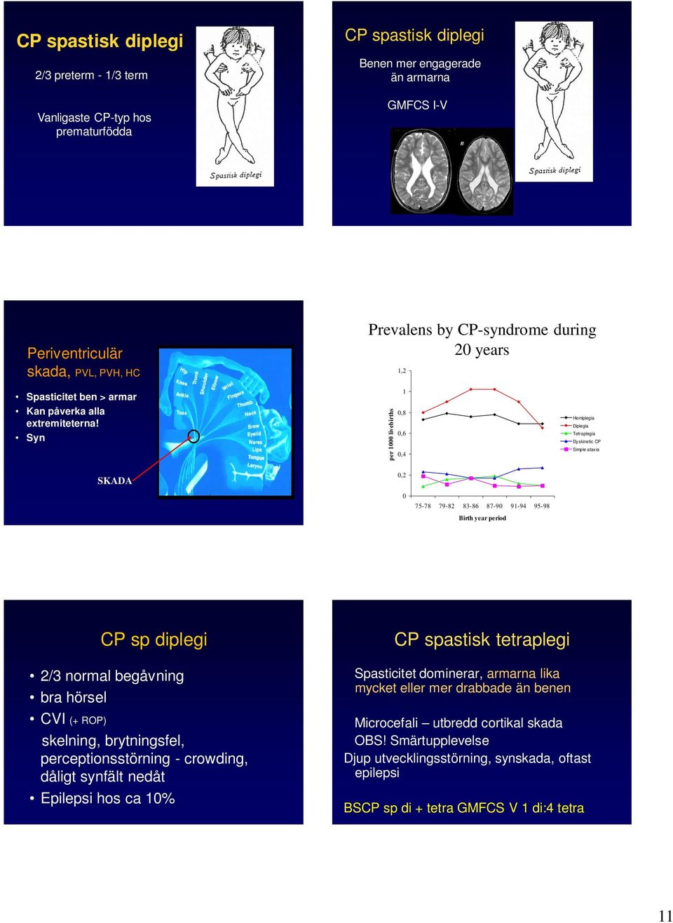 Syn SKADA per 1 livebirths 1,8,6,4,2 Hemiplegia Diplegia Tetraplegia Dyskinetic CP Simple ataxia 75-78 79-82 83-86 87-9 91-94 95-98 Birth year period CP sp diplegi 2/3 normal begåvning bra hörsel CVI