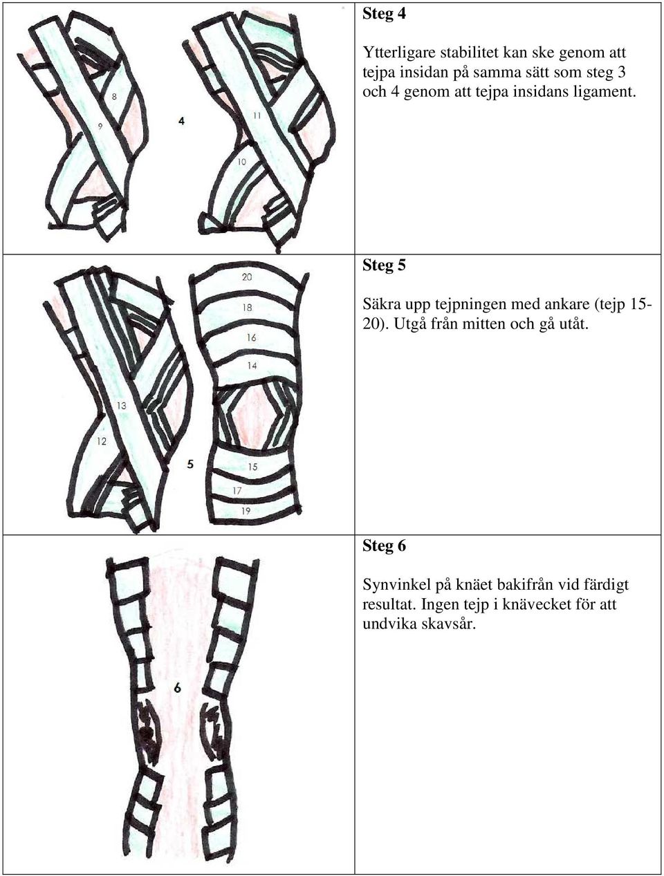 Steg 5 Säkra upp tejpningen med ankare (tejp 15-20).