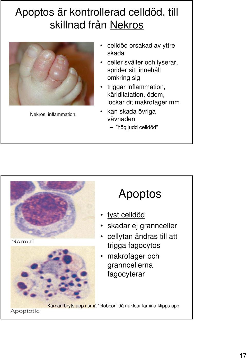 kärldilatation, ödem, lockar dit makrofager mm kan skada övriga vävnaden högljudd celldöd Apoptos tyst celldöd skadar