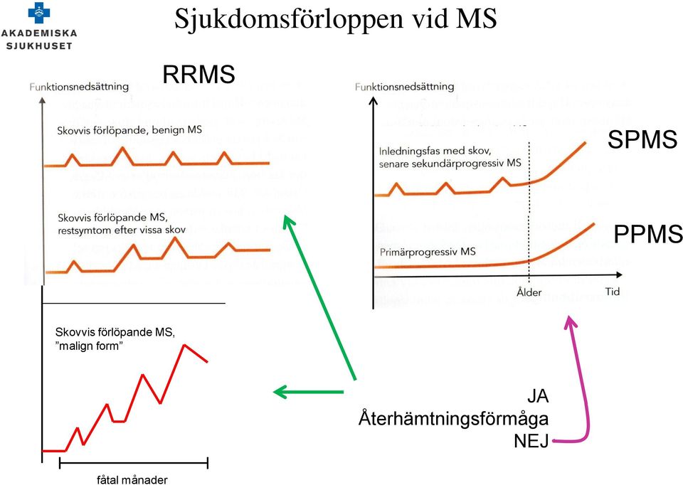 förlöpande MS, malign form