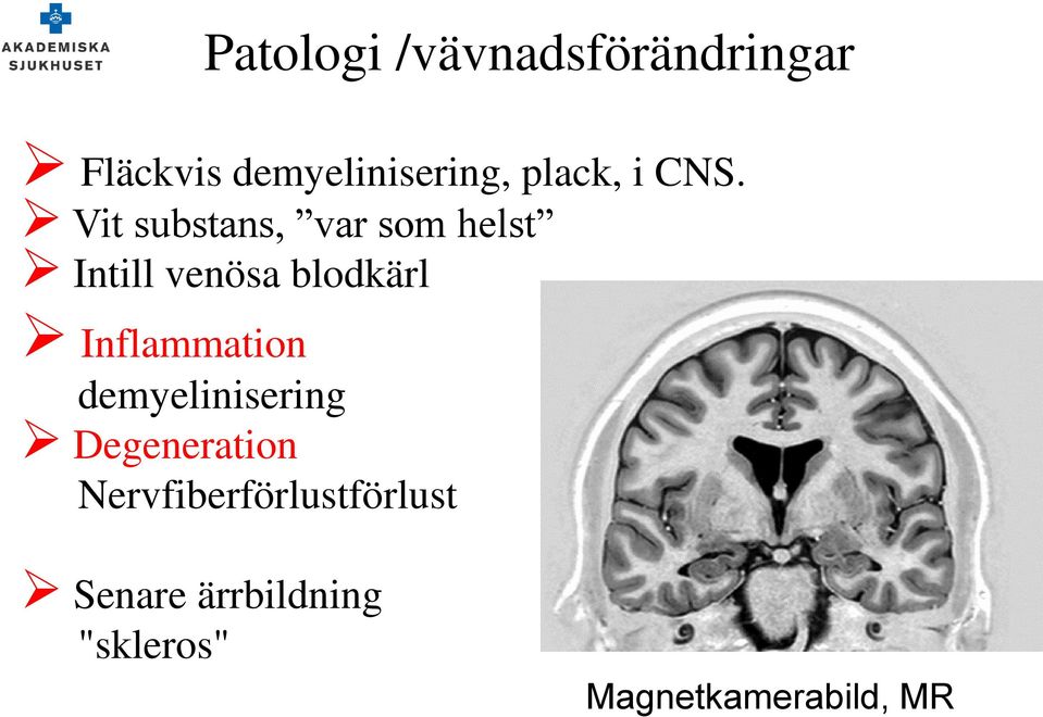 Vit substans, var som helst Intill venösa blodkärl