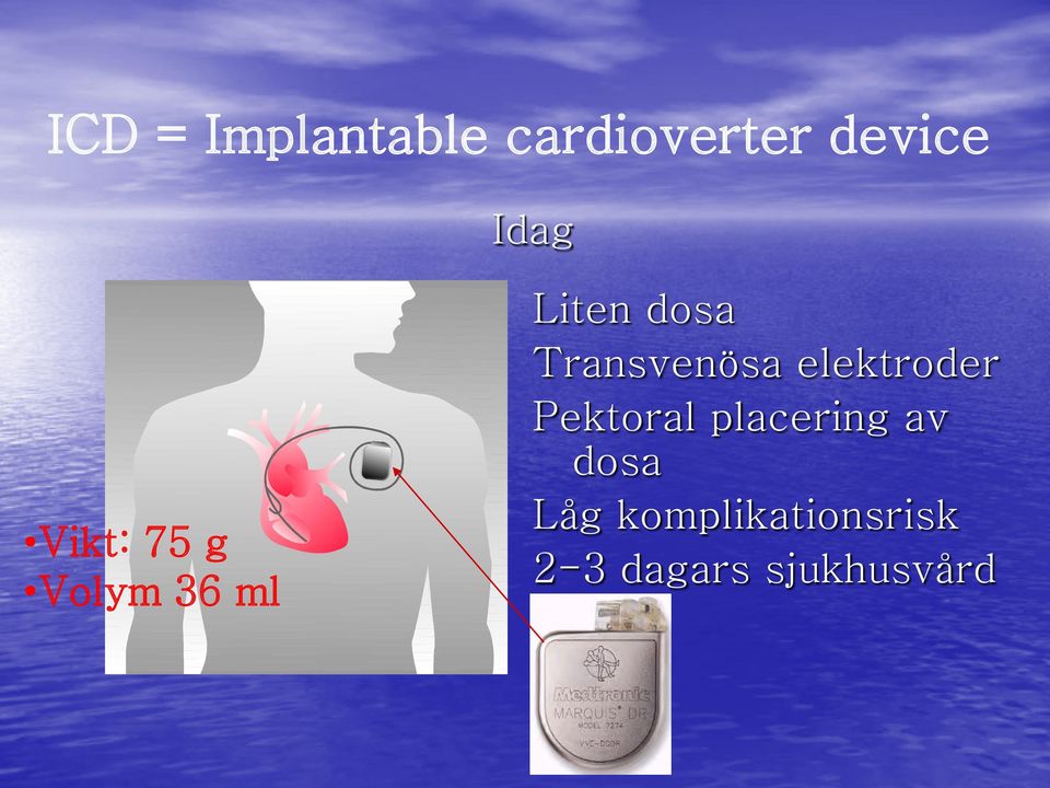 Transvenösa elektroder Pektoral placering