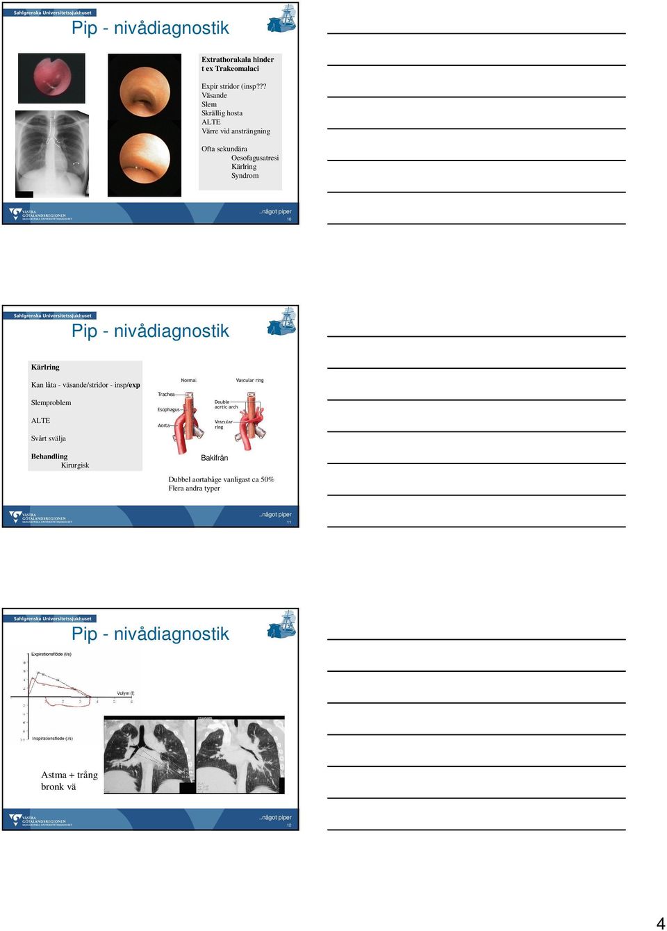 Kärlring Syndrom 10 Kärlring Kan låta - väsande/stridor - insp/exp Slemproblem ALTE Svårt