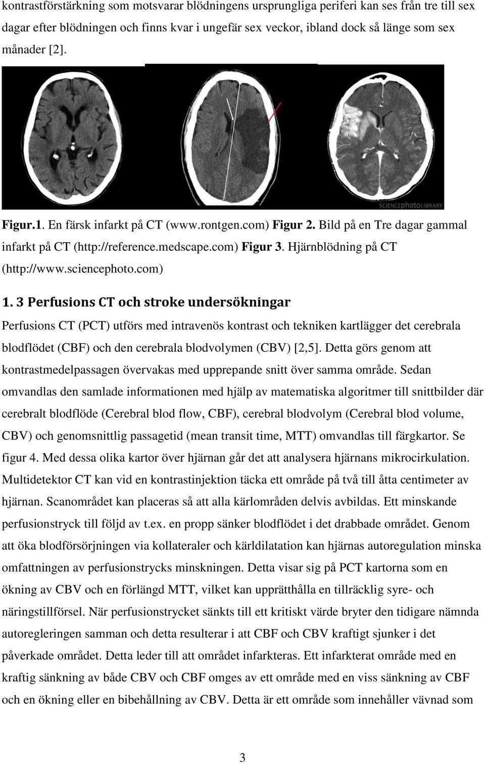 3 Perfusions CT och stroke undersökningar Perfusions CT (PCT) utförs med intravenös kontrast och tekniken kartlägger det cerebrala blodflödet (CBF) och den cerebrala blodvolymen (CBV) [2,5].