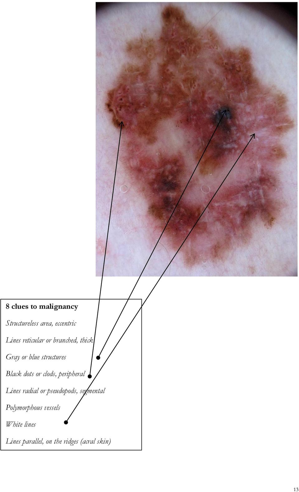 or clods, peripheral Lines radial or pseudopods, segmental