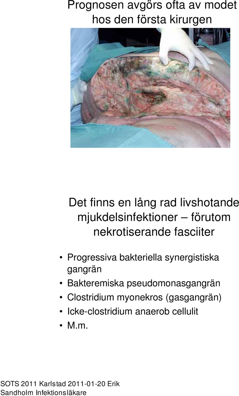 Progressiva bakteriella synergistiska gangrän Bakteremiska