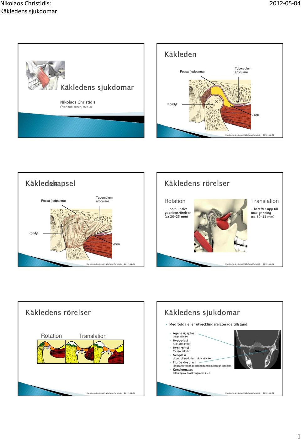 utvecklingsrelaterade tillstånd Rotation Translation Agenesi/aplasi ingen tillväxt Hypoplasi nedsatt tillväxt Hyperplasi för stor