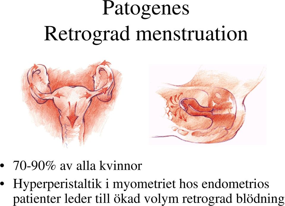 Hyperperistaltik i myometriet hos