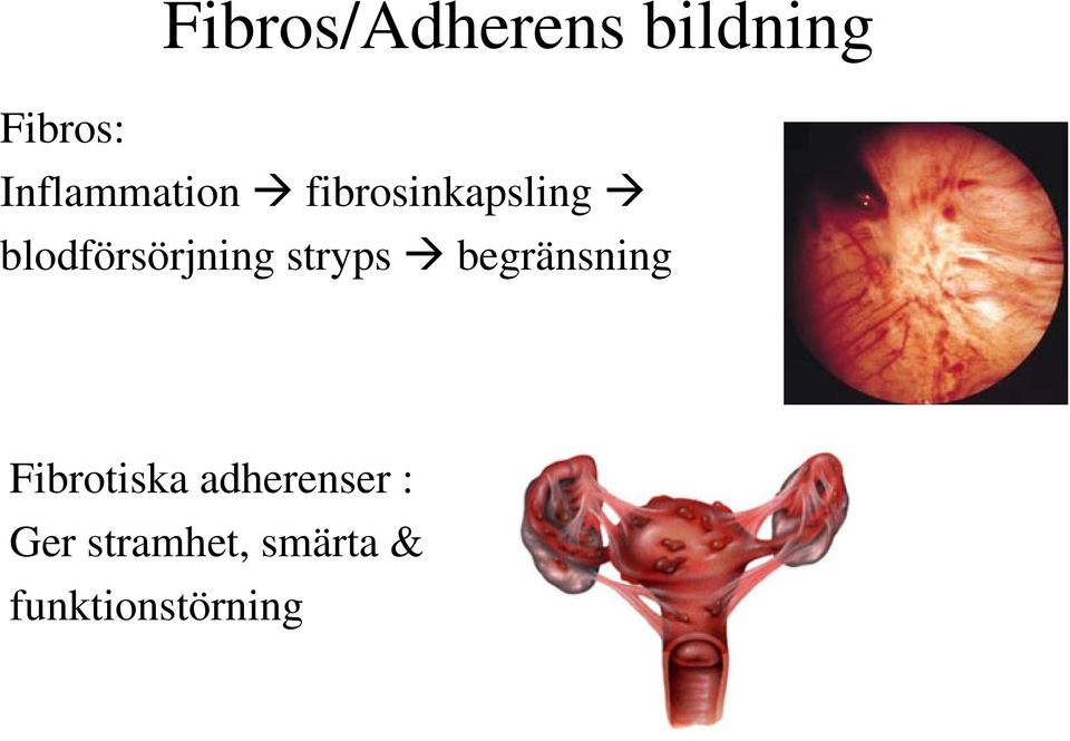 blodförsörjning stryps begränsning