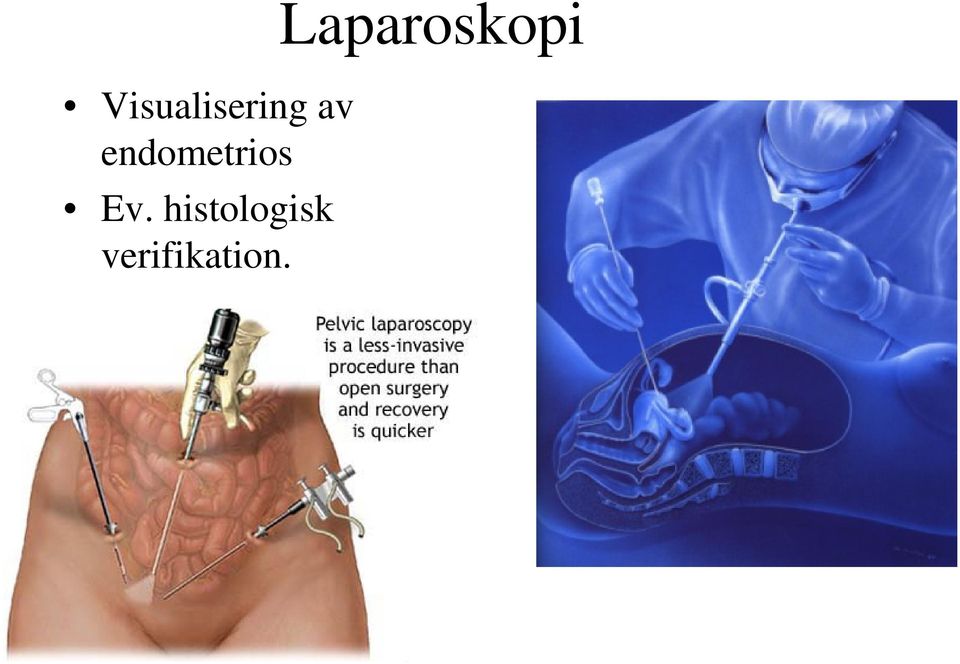 histologisk