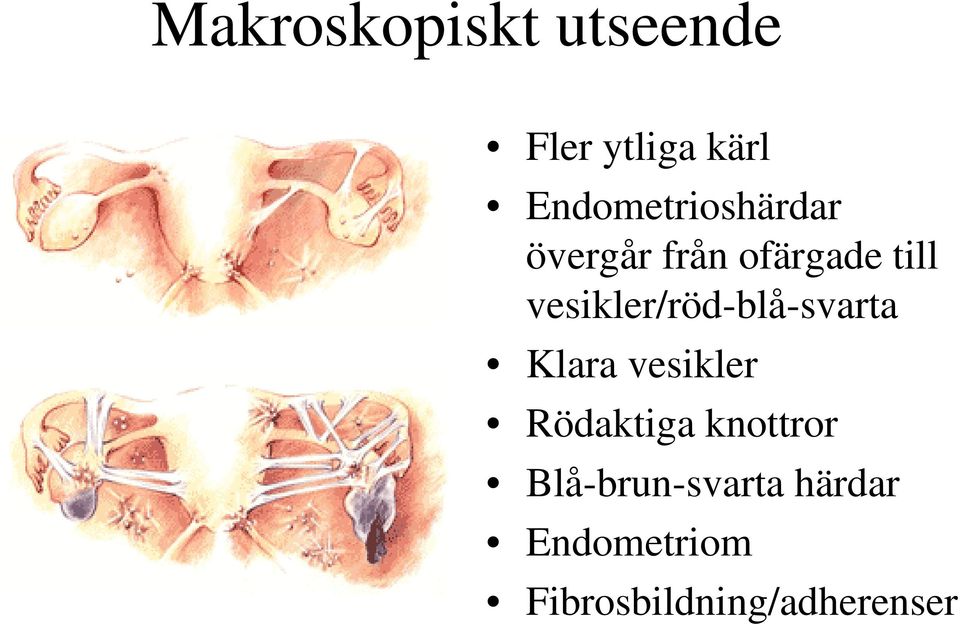 vesikler/röd-blå-svarta Klara vesikler Rödaktiga