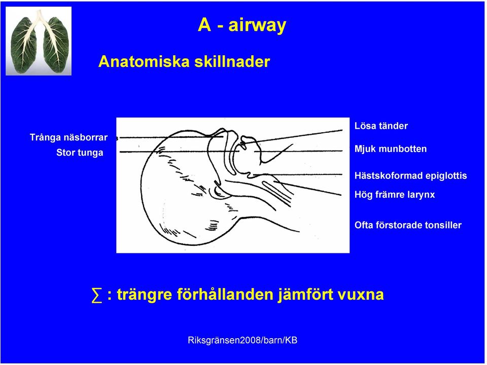 Hästskoformad epiglottis Hög främre larynx Ofta