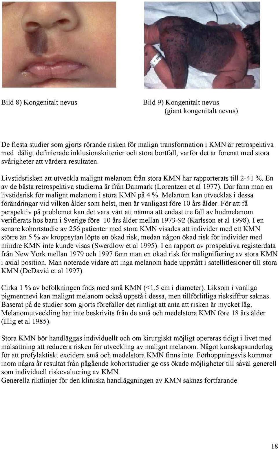 En av de bästa retrospektiva studierna är från Danmark (Lorentzen et al 1977). Där fann man en livstidsrisk för malignt melanom i stora KMN på 4 %.