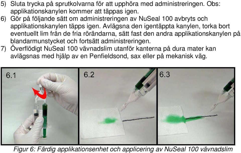 Avlägsna den igentäppta kanylen, torka bort eventuellt lim från de fria rörändarna, sätt fast den andra applikationskanylen på blandarmunstycket och