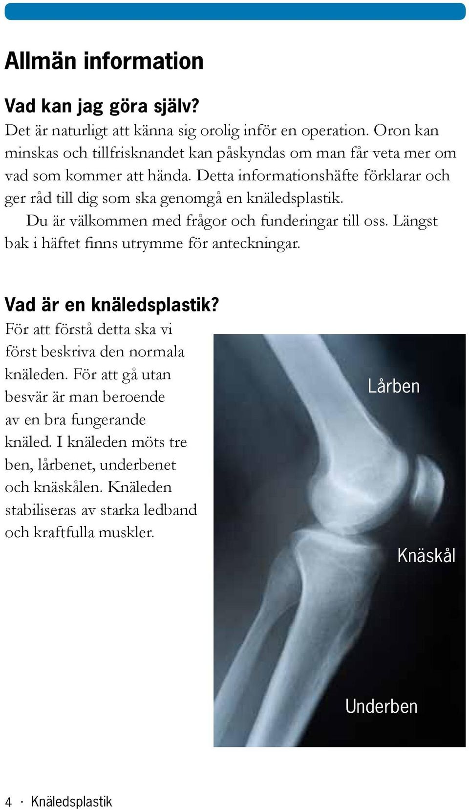 Detta informationshäfte förklarar och ger råd till dig som ska genomgå en knäledsplastik. Du är välkommen med frågor och funderingar till oss.