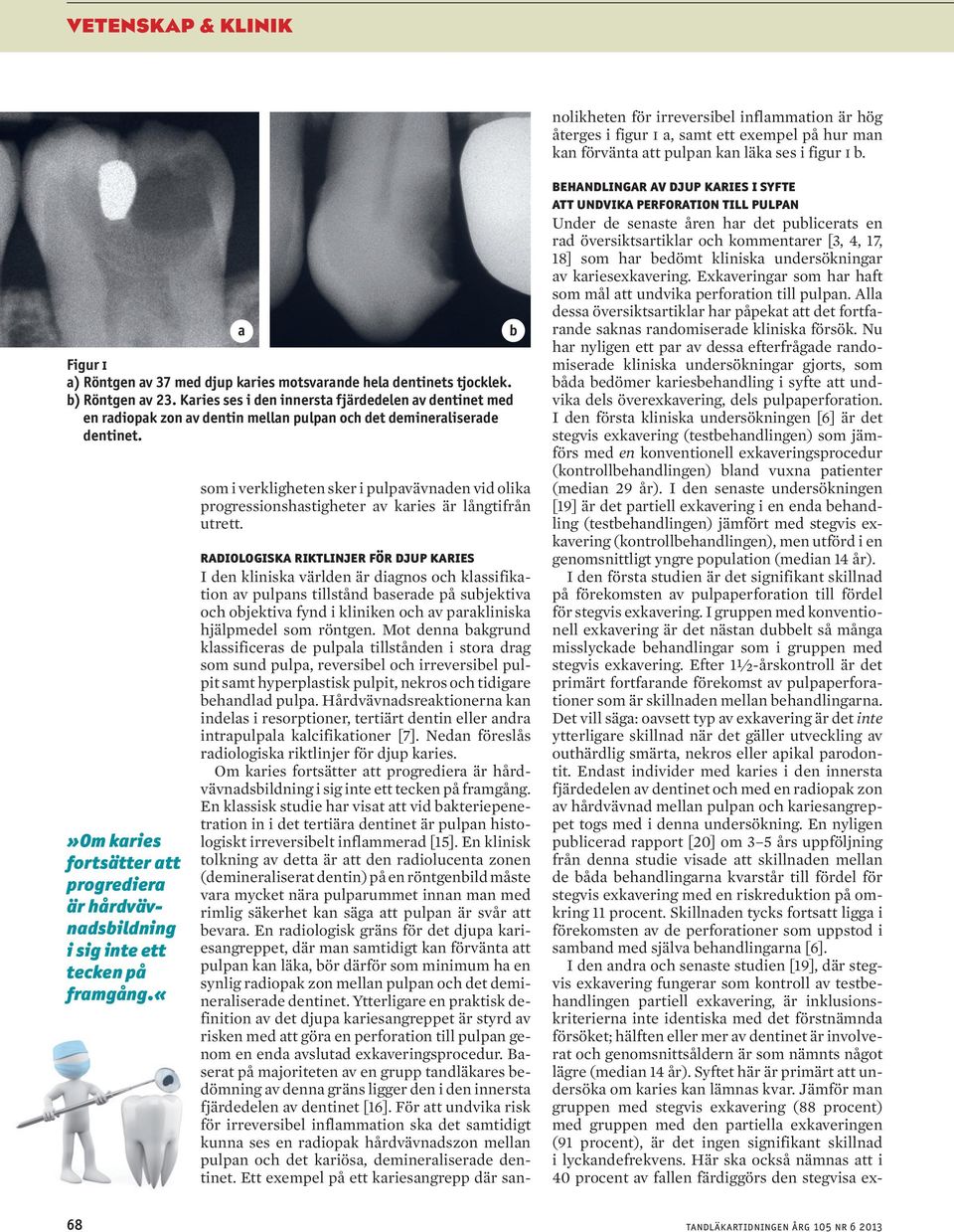 Hårdvävnadsreaktionerna kan indelas i resorptioner, tertiärt dentin eller andra intrapulpala kalcifikationer [7]. Nedan föreslås radiologiska riktlinjer för djup karies.