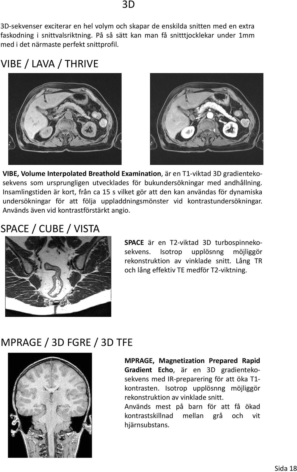 VIBE / LAVA / THRIVE VIBE, Volume Interpolated Breathold Examination,är en T1 viktad 3D gradientekosekvens som ursprungligen utvecklades för bukundersökningar med andhållning.