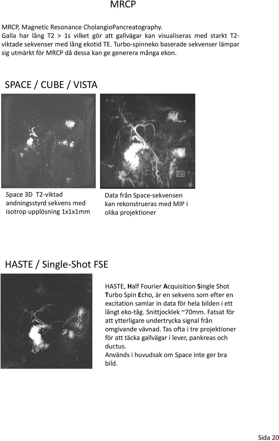 SPACE / CUBE / VISTA Space 3D T2 viktad andningsstyrd sekvens med isotrop upplösning 1x1x1mm Data från Space sekvensen kan rekonstrueras med MIP i olika projektioner HASTE / Single Shot FSE HASTE,