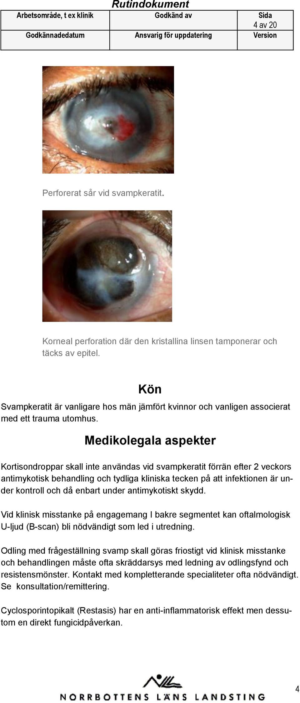 Medikolegala aspekter Kortisondroppar skall inte användas vid svampkeratit förrän efter 2 veckors antimykotisk behandling och tydliga kliniska tecken på att infektionen är under kontroll och då