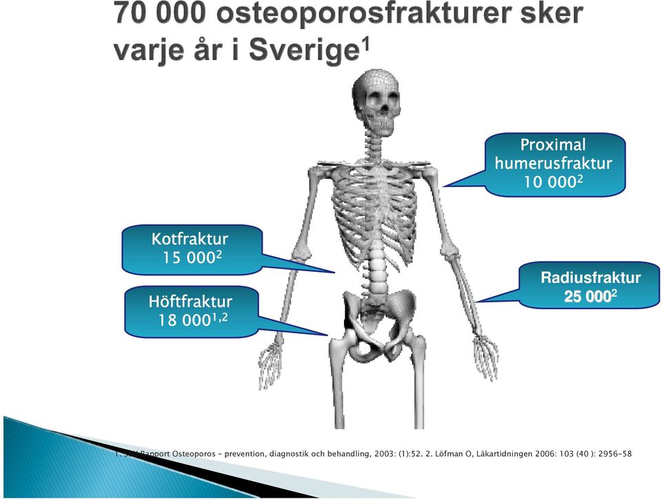 SBU Rapport Osteoporos prevention, diagnostik och