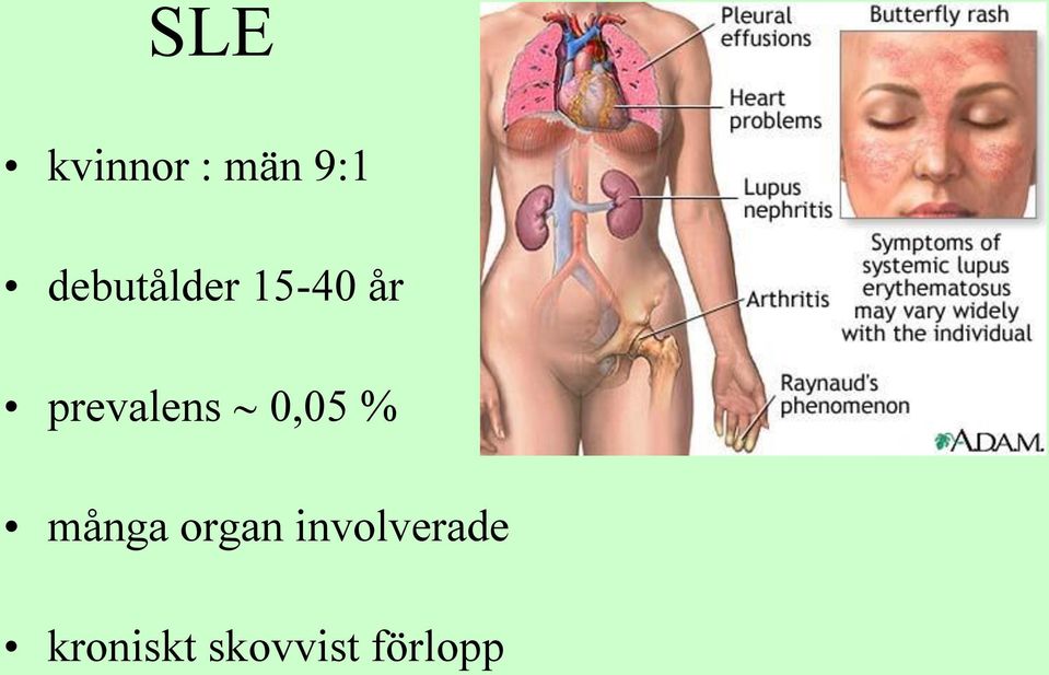 prevalens 0,05 % många