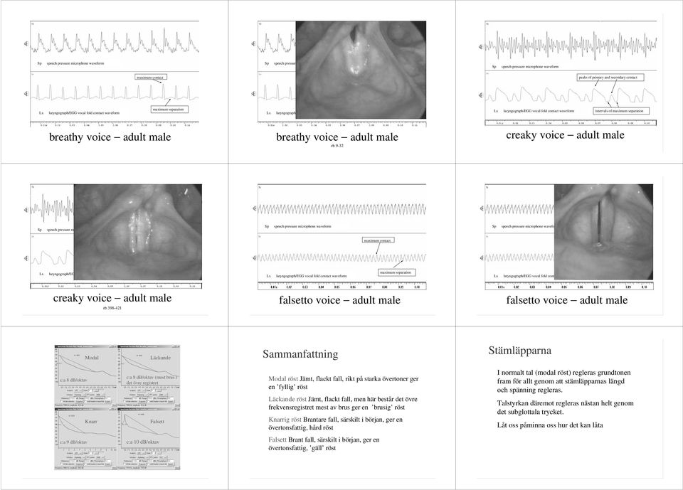 db/oktav Knarr c:a 8 db/oktav (mest brus i det övre registret Falsett Modal röst Jämt, flackt fall, rikt på starka övertoner ger en fyllig röst Läckande röst Jämt, flackt fall, men här består det