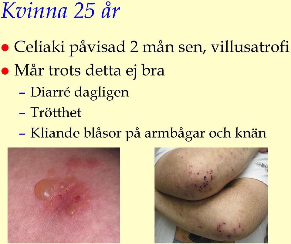 detta ej bra Diarré dagligen