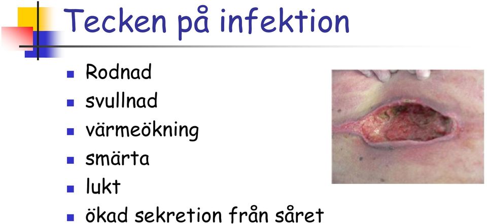värmeökning smärta