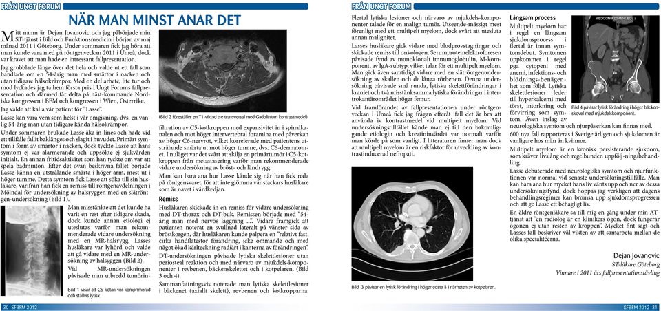 Primärt symtom i form itt namn är Dejan Jovanovic och av smärtor jag påbörjade i nacken, dock min tycket ST-tjänst i Bild och Funktionsmedicin Lasse att hans i början symtom av ej maj var alarmerande