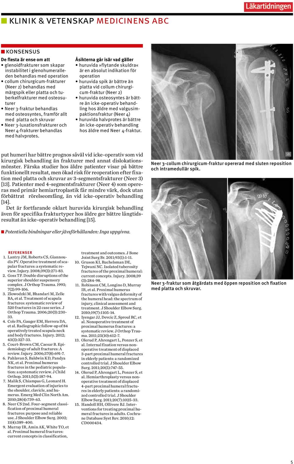 Åsikterna går isär vad gäller huruvida»flytande skuldra«är en absolut indikation för operation huruvida spik är bättre än platta vid collum chirurgicum-fraktur (Neer 2) huruvida osteosyntes är bättre