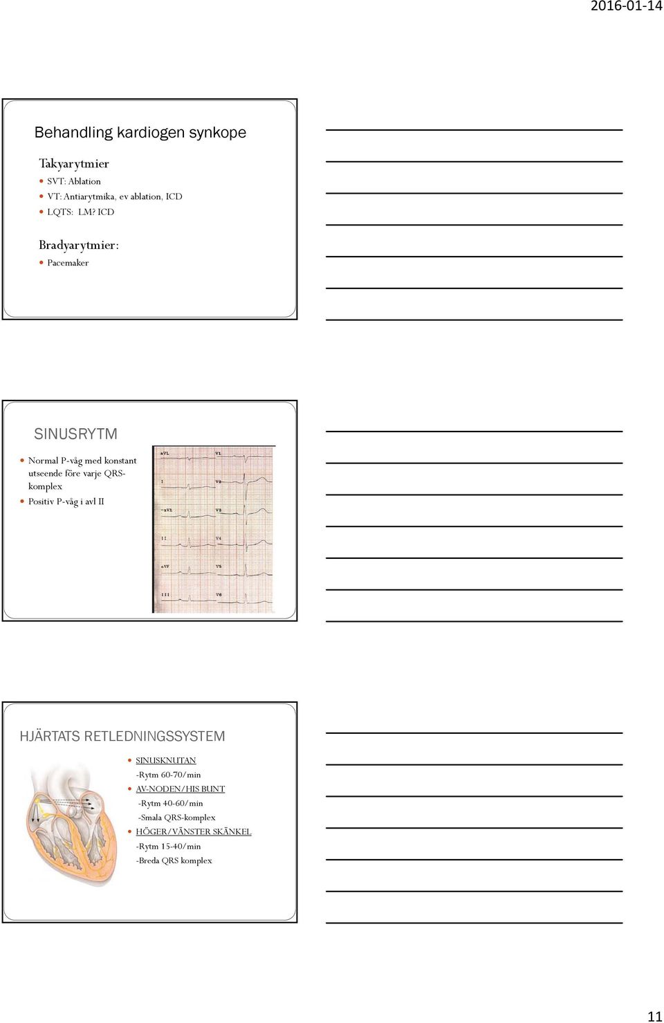 Synkope och bradykardi. Kristina Rydlund - PDF Gratis nedladdning