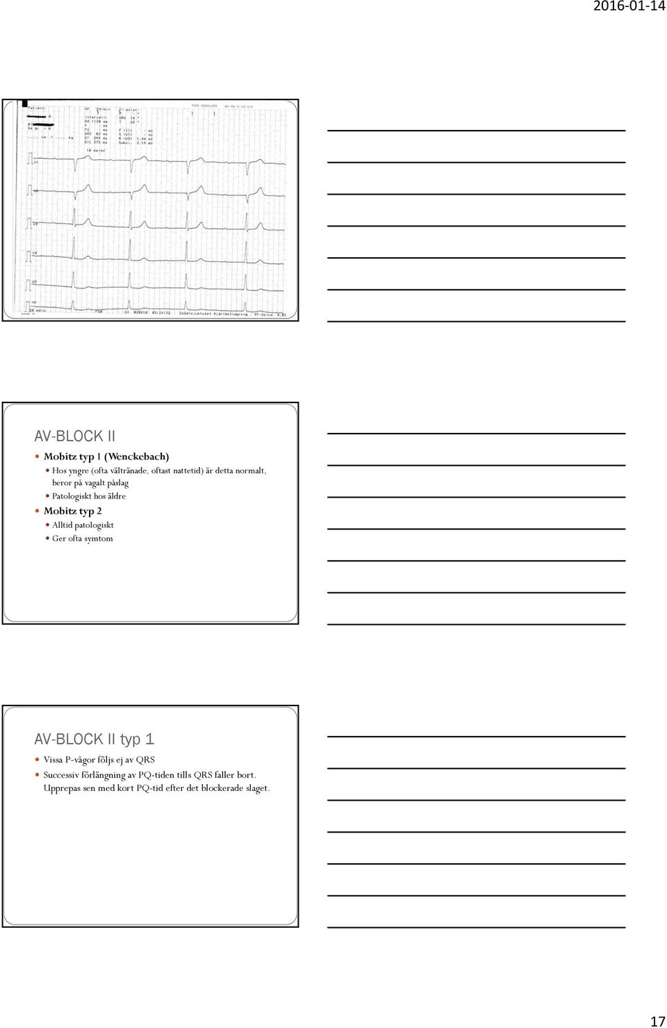 Synkope och bradykardi. Kristina Rydlund - PDF Gratis nedladdning