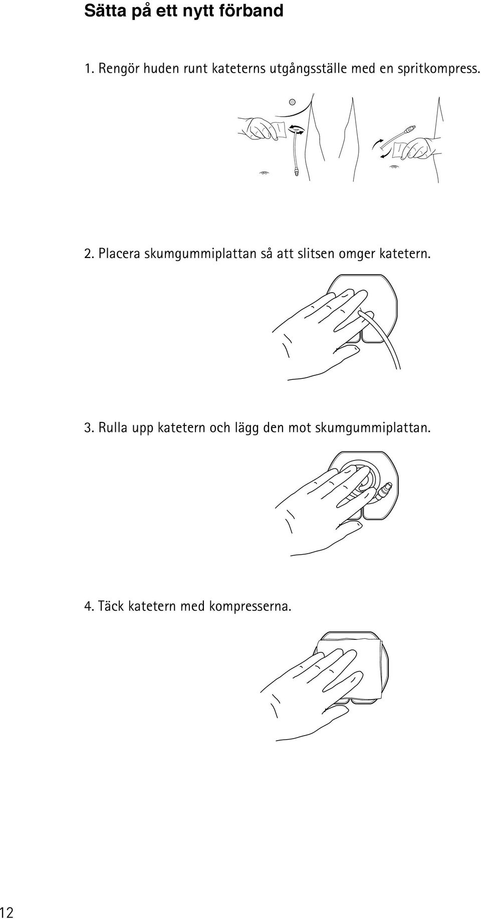 2. Placera skumgummiplattan så att slsen omger katetern. 3.
