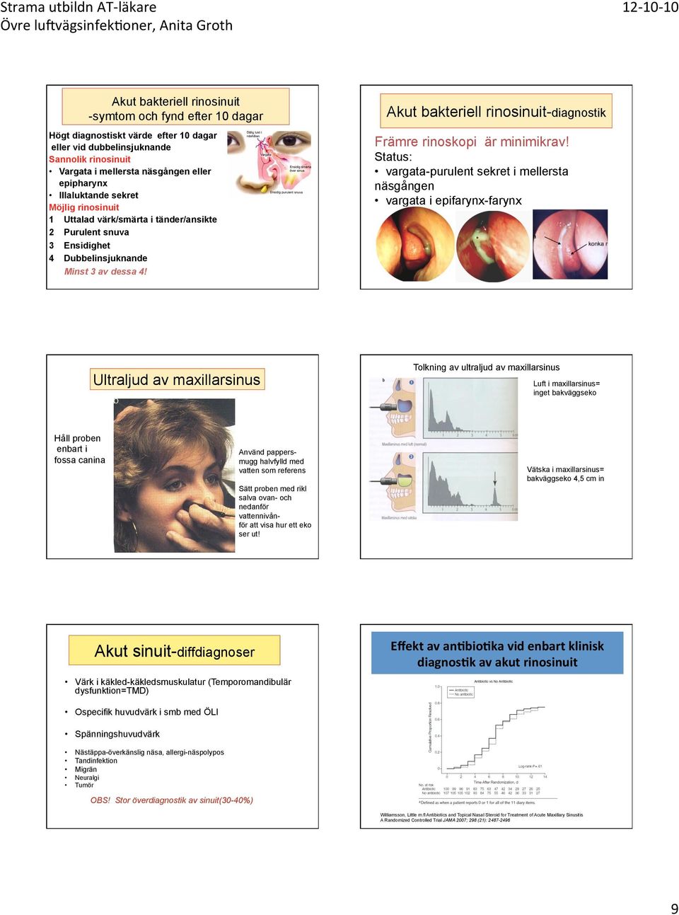 Akut bakteriell rinosinuit-diagnostik Främre rinoskopi är minimikrav!