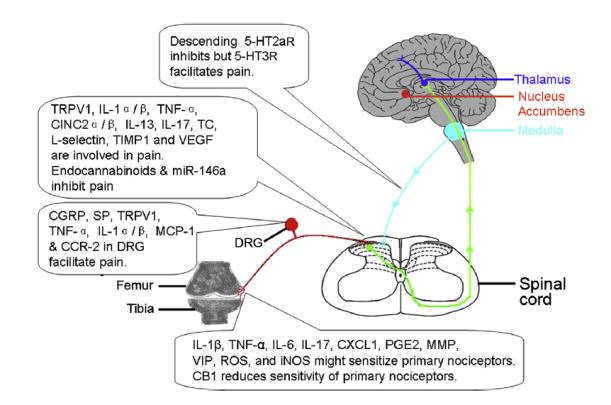 Gone should be the notion that a person with knee pain and normal radiographs could not have OA.