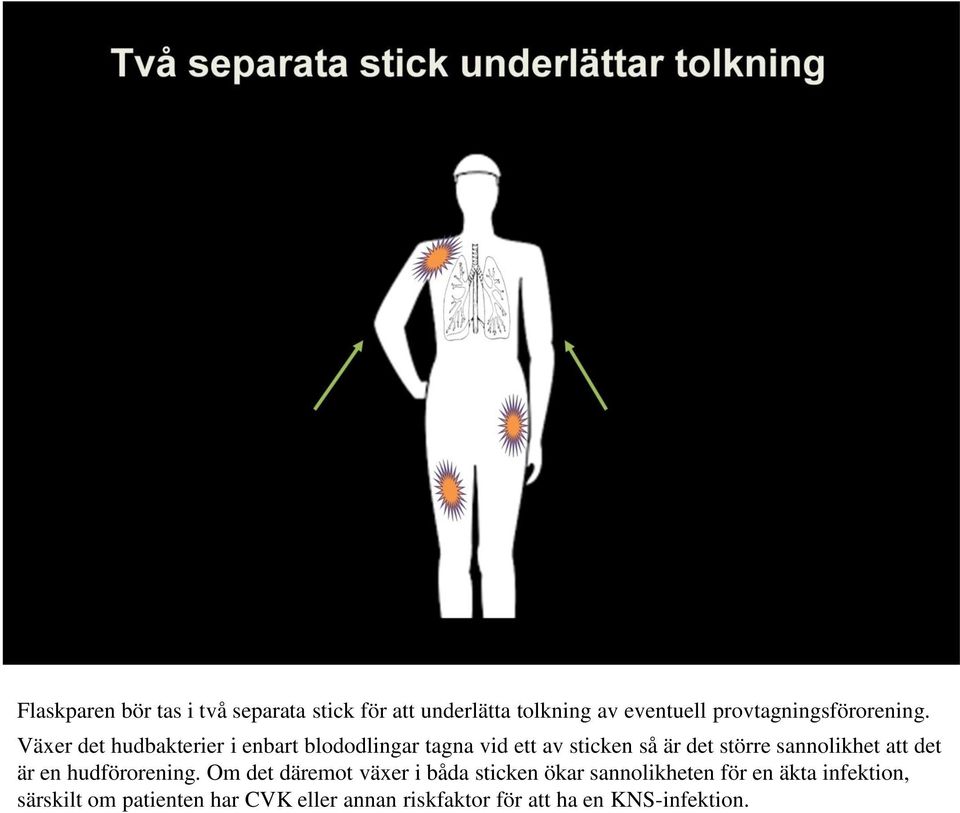 Växer det hudbakterier i enbart blododlingar tagna vid ett av sticken så är det större