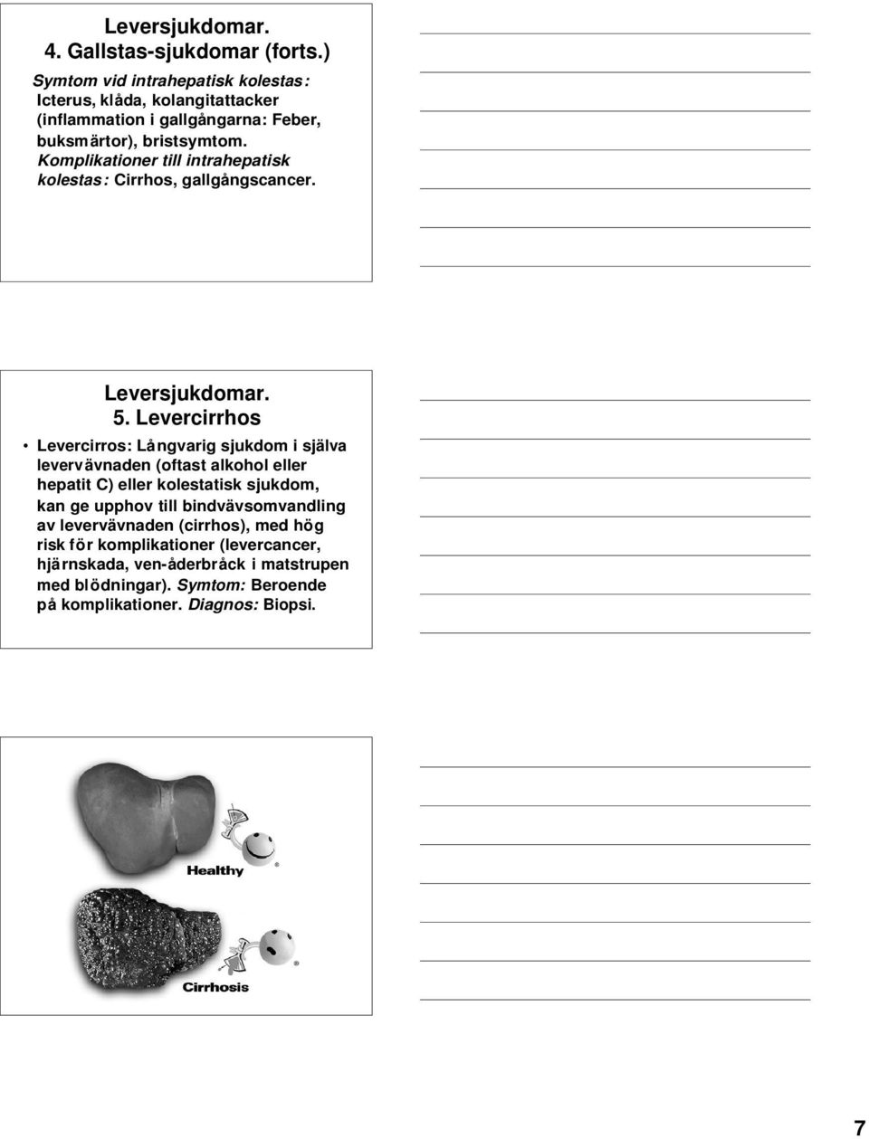 Komplikationer till intrahepatisk kolestas: Cirrhos, gallgångscancer. 5.