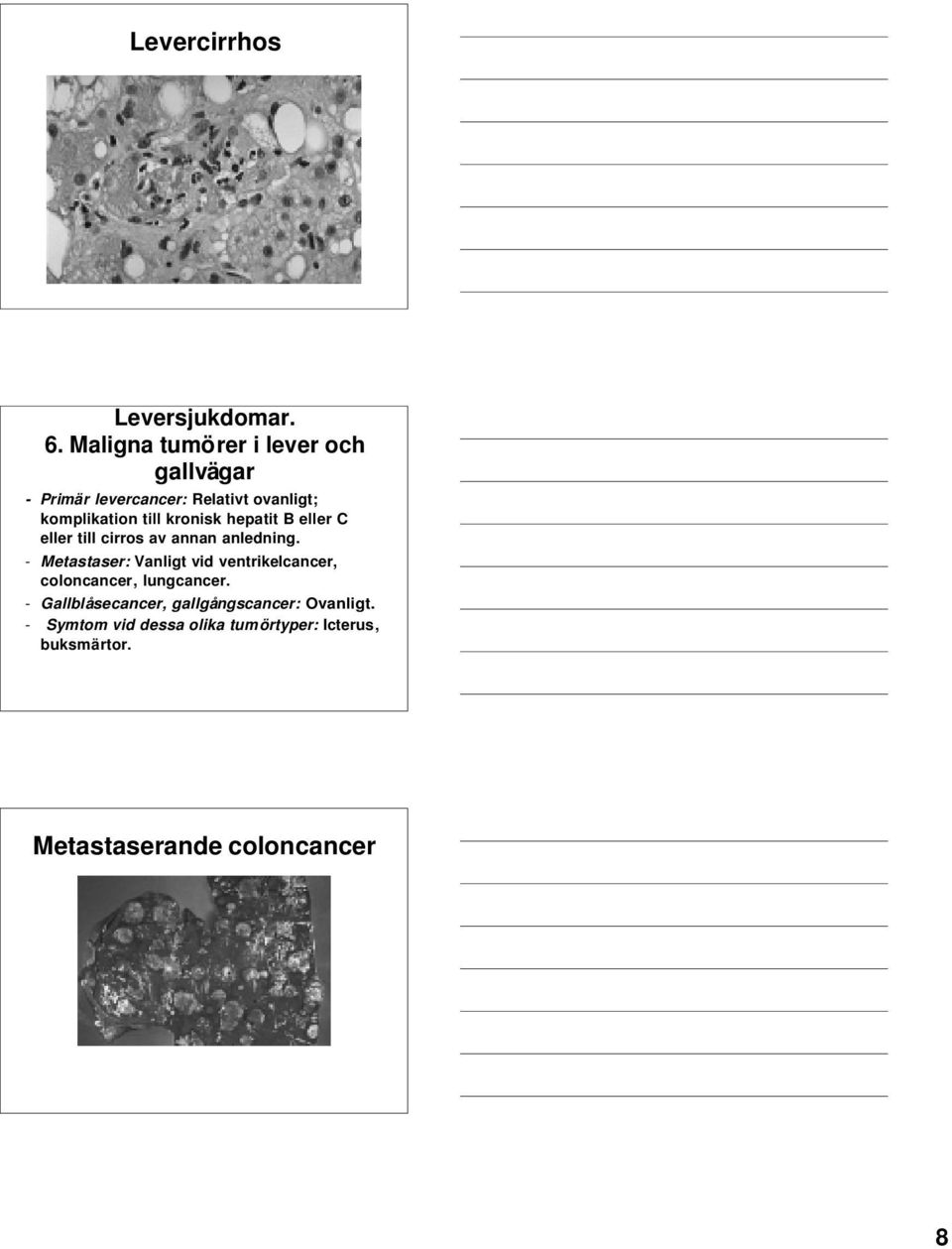 till kronisk hepatit B eller C eller till cirros av annan anledning.