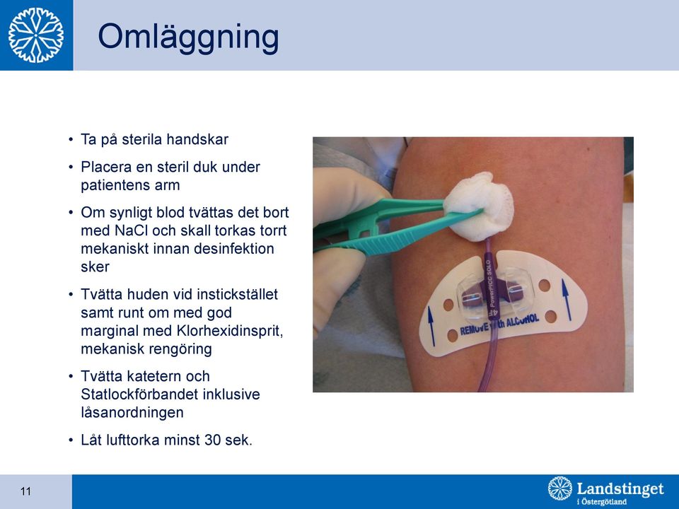 huden vid instickstället samt runt om med god marginal med Klorhexidinsprit, mekanisk