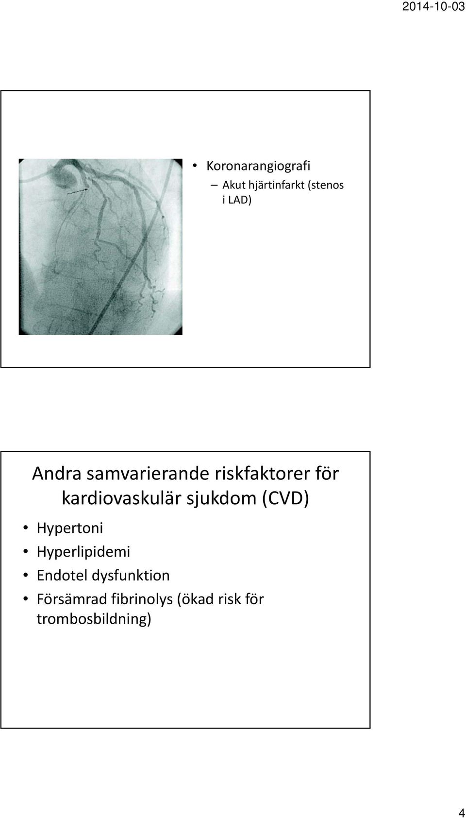 sjukdom (CVD) Hypertoni Hyperlipidemi Endotel