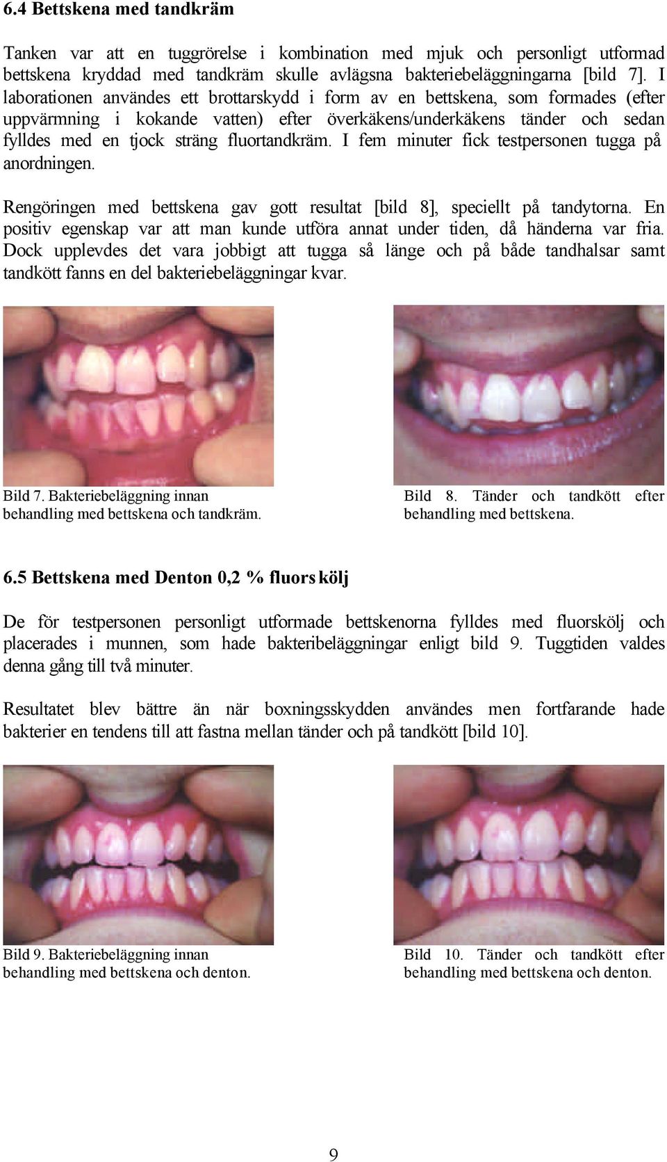 fluortandkräm. I fem minuter fick testpersonen tugga på anordningen. Rengöringen med bettskena gav gott resultat [bild 8], speciellt på tandytorna.