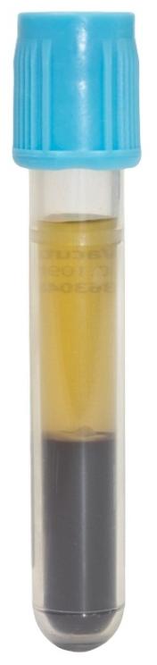 Centrifugering Tube Type Glass Na Citrate & CTAD Faktorer CLSI (H21-A5): 1500 x g (RCF), minst 15 min, RT Platelet Poor Plasma (platelet count <10,000/μL per CLSI H18-A4 guideline) Time (min) x g