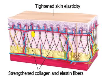 Hur fungerar det Mickroströmmen bidrar till att öka ATP balansen i cellerna vilket ger en mjuk och elastisk hud, förbättrar rynkor, minskar ärr.