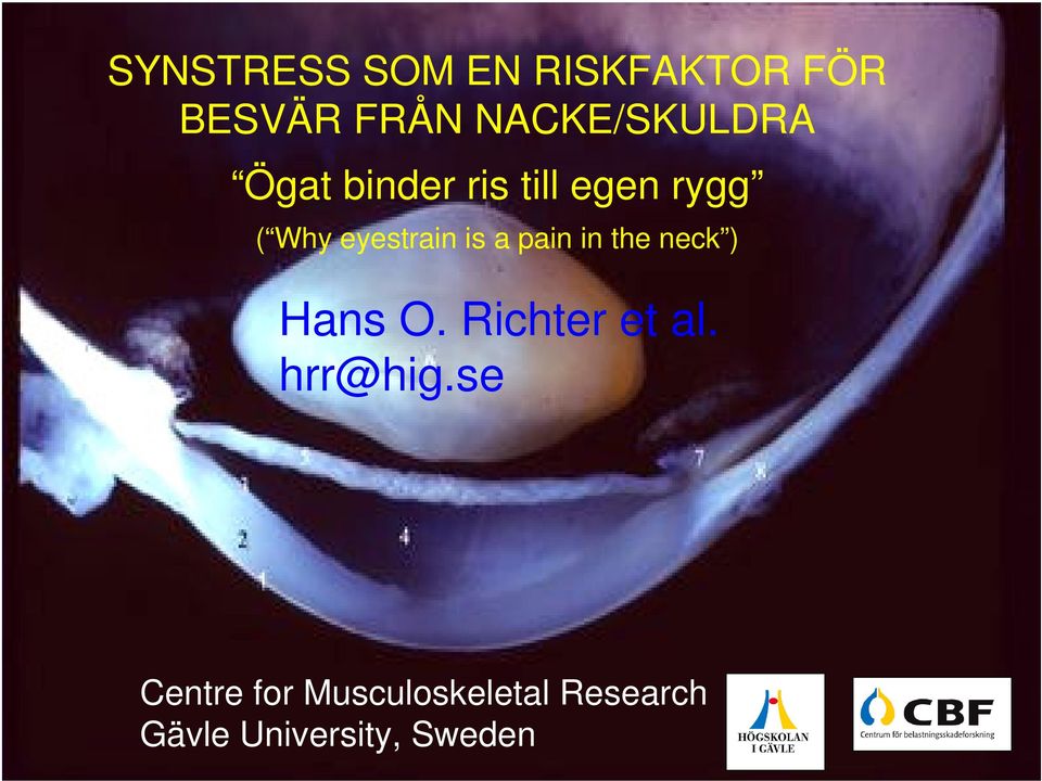 eyestrain is a pain in the neck ) Hans O. Richter et al.