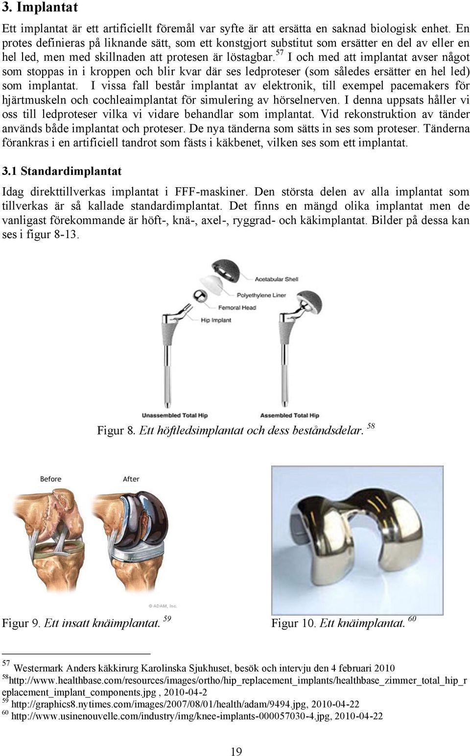 57 I och med att implantat avser något som stoppas in i kroppen och blir kvar där ses ledproteser (som således ersätter en hel led) som implantat.